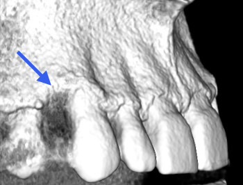 Parodontologia - Caso Clinico